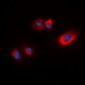 Anti-HSP20 (pS16) Antibody